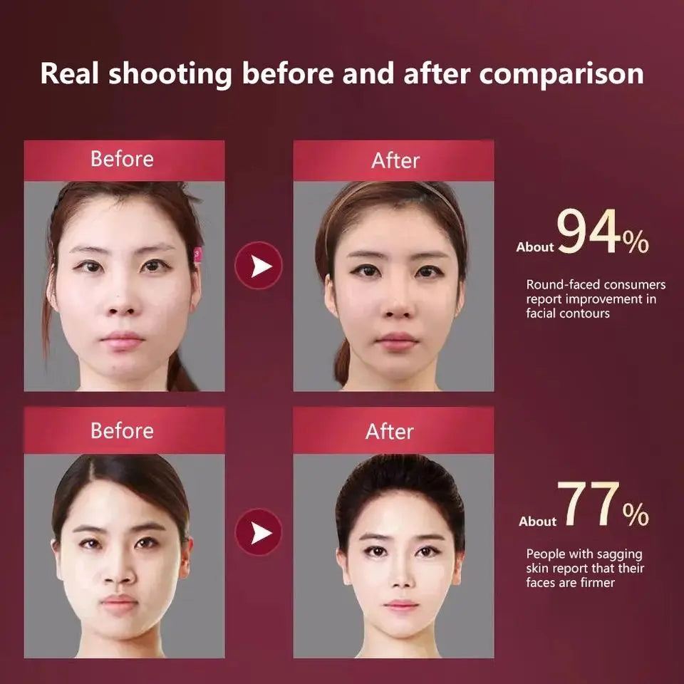 Radiance Lift LED Photon Facial Slimming Massager