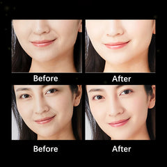 Anti Wrinkle Patches for Aging Face, Eye Mask, Forehead, and Neck Success