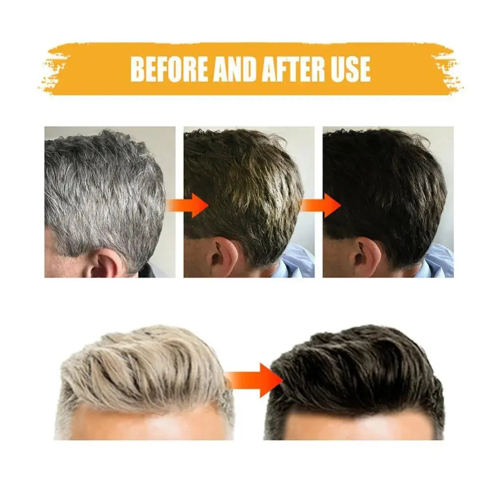Hair Darkening Shampoo Bar Soap Anti Dandruff Deep Beautiful Black Cleansing Nourishment Hair Improve Gray White Men - MaJuah
